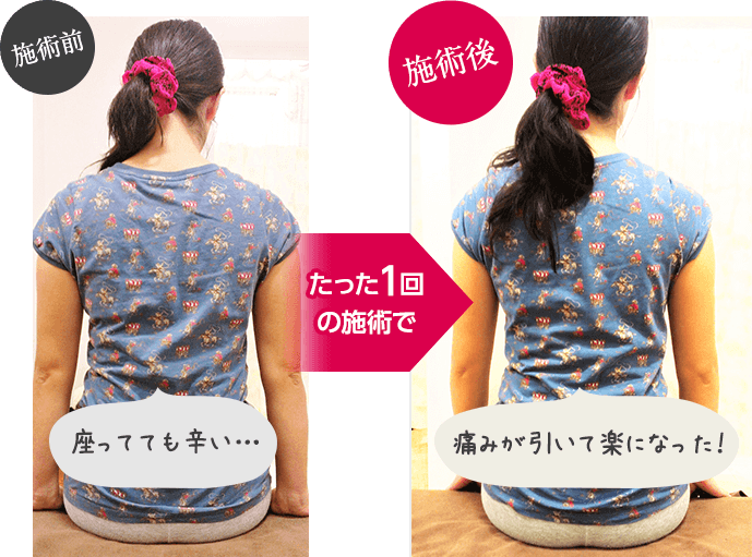 施術前→施術後